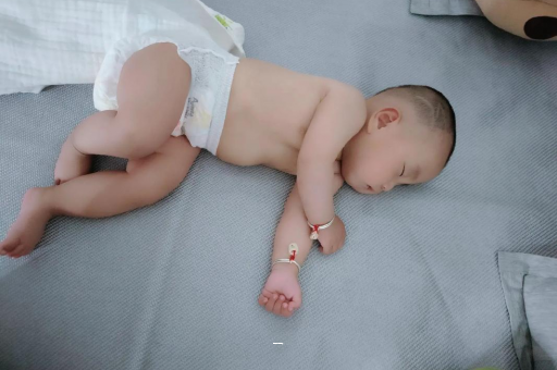 黄骅宝宝脸上有白色斑块